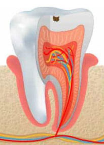 dienteda1